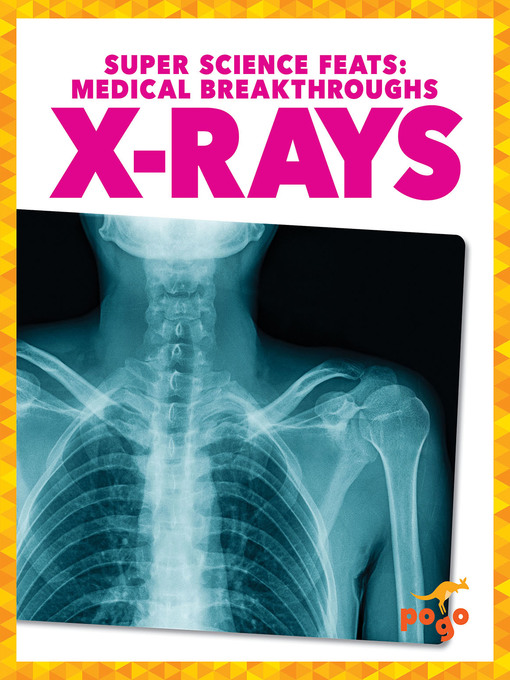 Title details for X-Rays by Alicia Z. Klepeis - Available